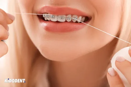 floss with permanent retainer