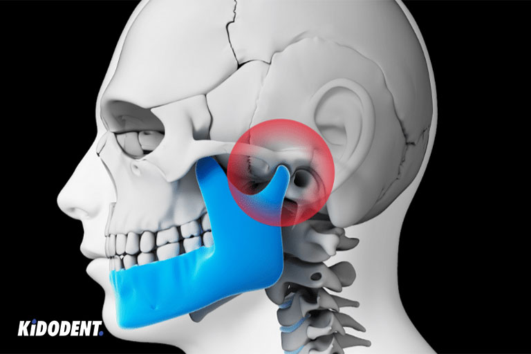 Eating large bits and hard foods can make TMJ worse