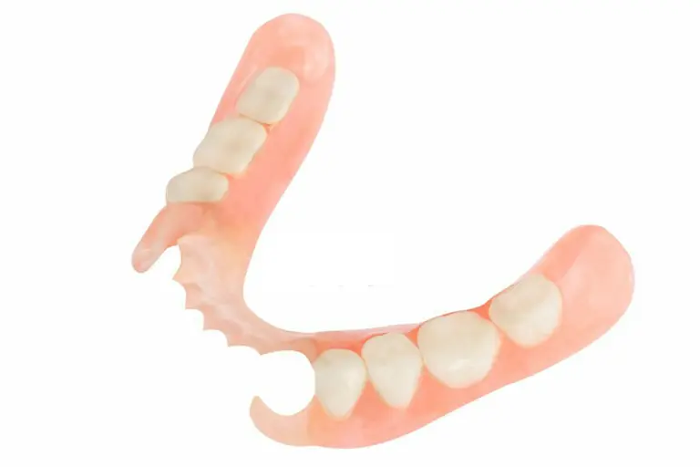 flexible partial dentures