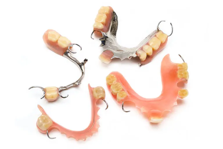 Removable partial dentures acrylic and metal