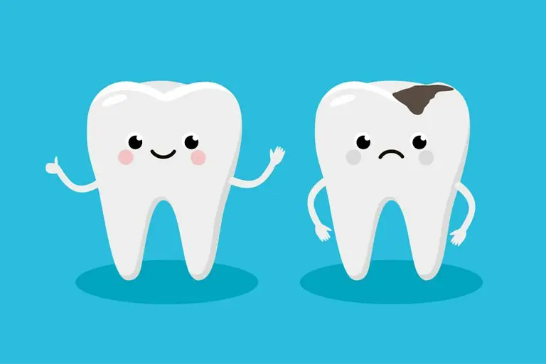 tooth decay and cavities in children